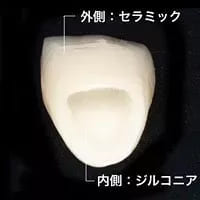 ジルコニアセラミック