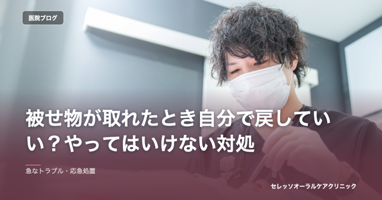 被せ物が取れたとき自分で戻していい？やってはいけない対処 のアイキャッチ画像
